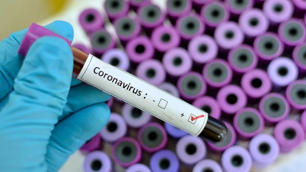 شناسایی ۱۱ هزار و ۹۶۴ بیمار جدید مبتلا به کووید۱۹ در کشور