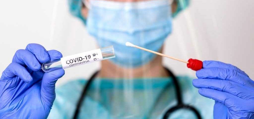شناسایی ۸۶ بیمار جدید کووید۱۹ در شبانه روز گذشته در کشور