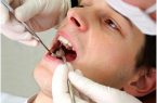 مردم به دلیل هزینه بالای خدمات دندانپزشکی اقدام به کشیدن دندان‌های خود می‌کنند/ دولت برای سلامت جامعه بیمه‌ها را پای کار بیاورد